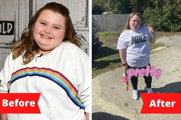 Before-after-honey-boo-boo (Final)